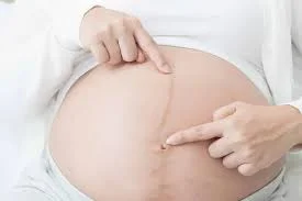 Những dấu hiệu mang thai con gái mà mẹ nên biết
